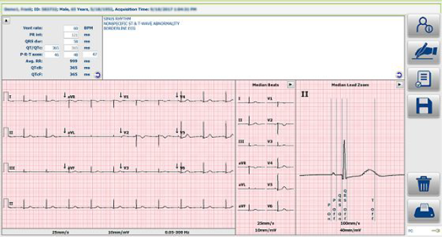 Report Displayed in Diagnostic Cardiology Suite