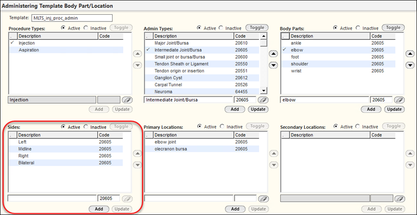 Sides configuration on Injection and Aspiration template
