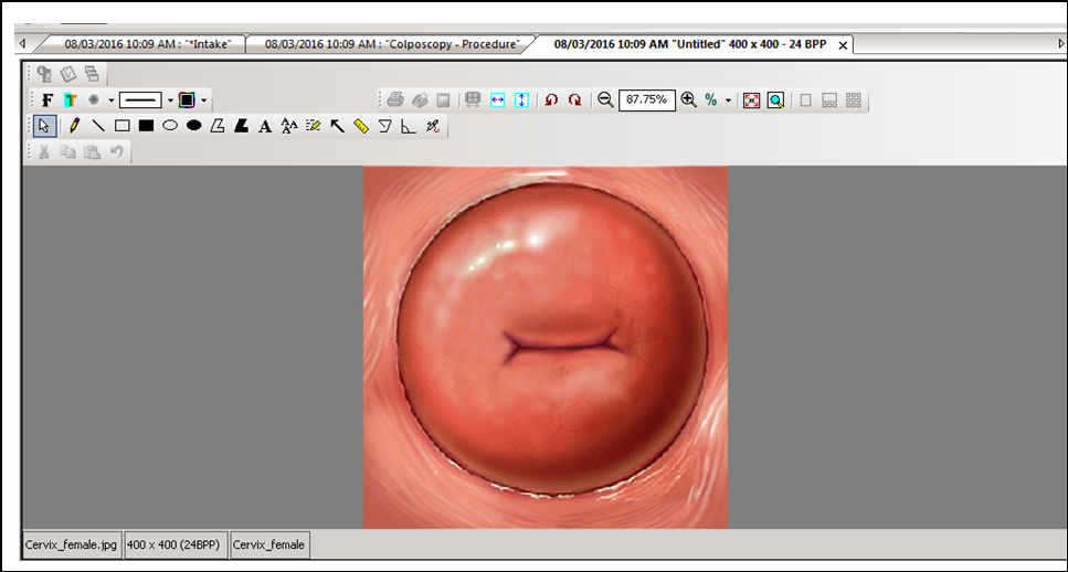 Cervix Image