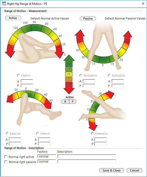Right Hip Range of Motion - PE