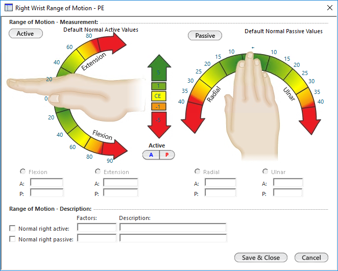 Right Wrist Range of Motion - PE
