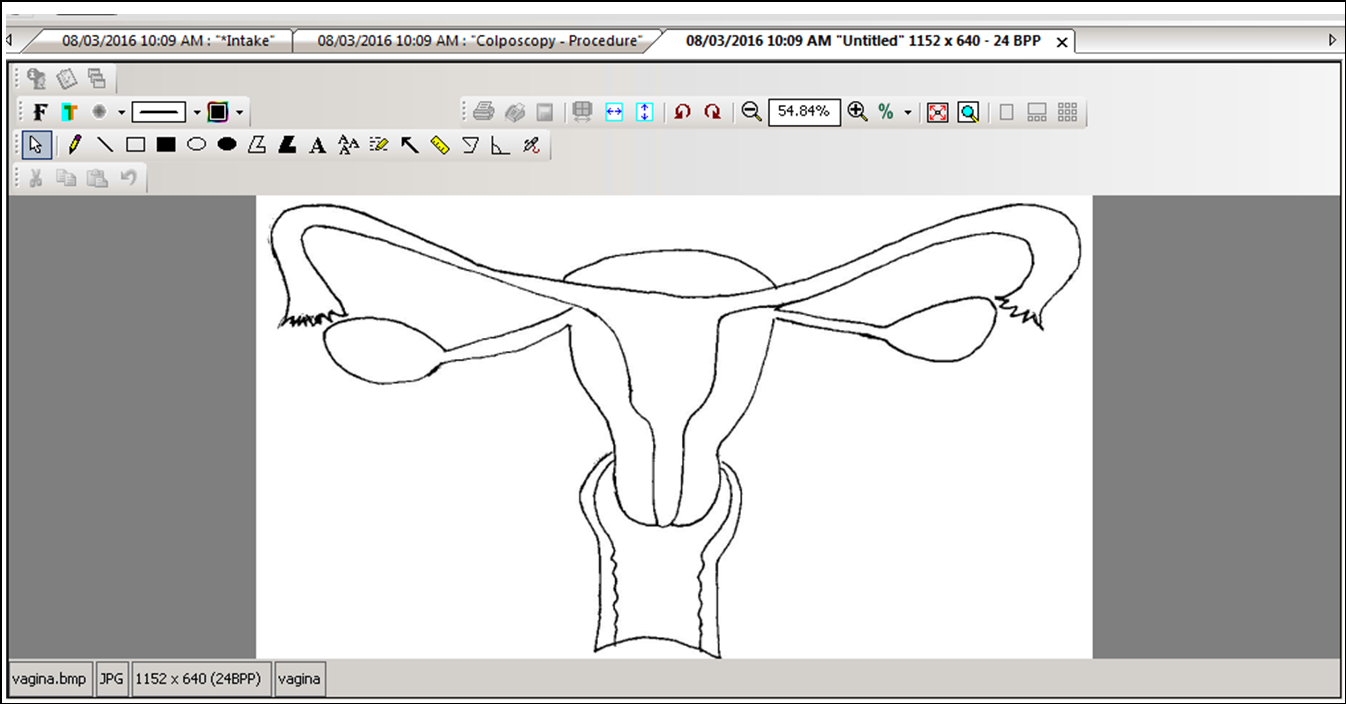 Vagina Image