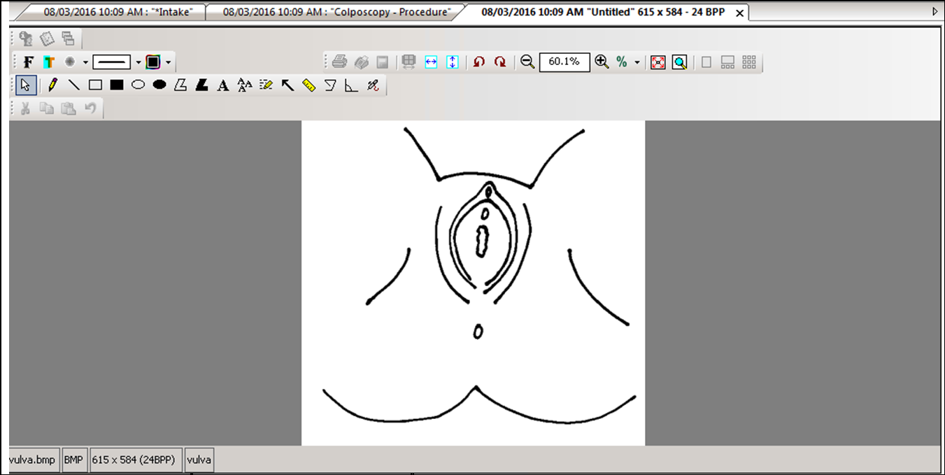 Vulva Image