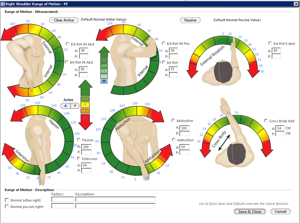 Right Shoulder Range of Motion-PE