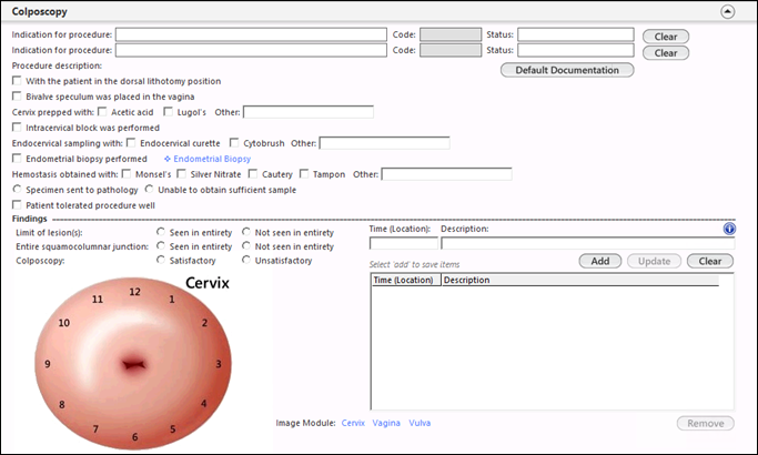 Colposcopy – Procedure template