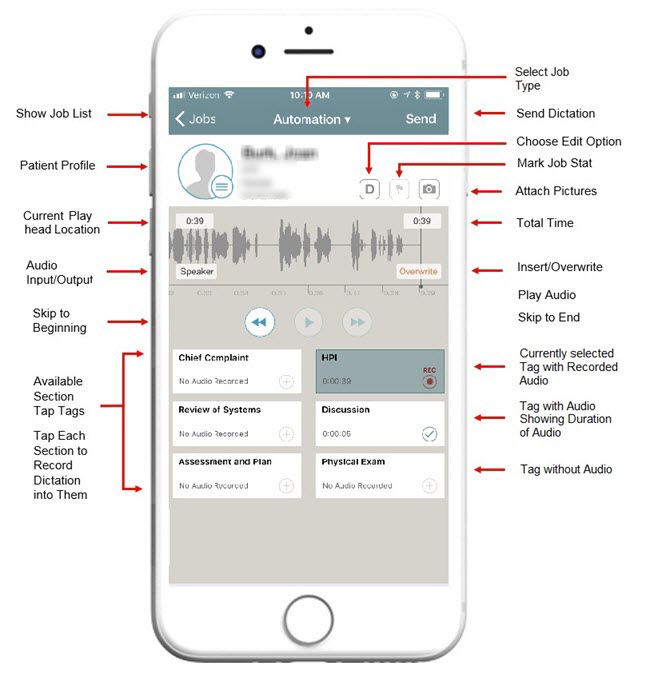 NextGen Mobile Dictation Rhythm UI description for iOS
